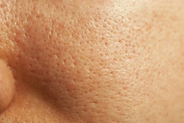 What are the best ways to get rid of large pores?